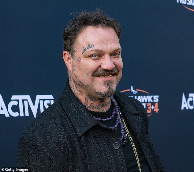Bam Margera (seen in LA back in May) candidly revealed that he nearly lost his legs due to his battle with alcohol abuse
