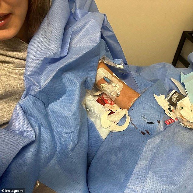 The brunette beauty wasn't afraid to show her fans an unvarnished view of her treatments two years ago