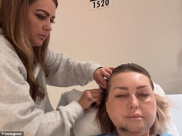 Letitia said the damage to her face has 'depressing' and 'painful'